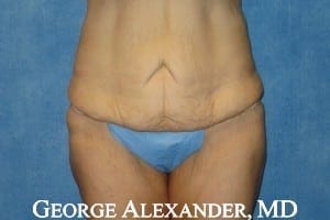 Naked woman with a blue thin material wrapped around her hips