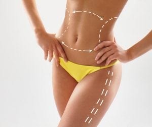Women slim body in swimwear having arrows along her stomach and legs