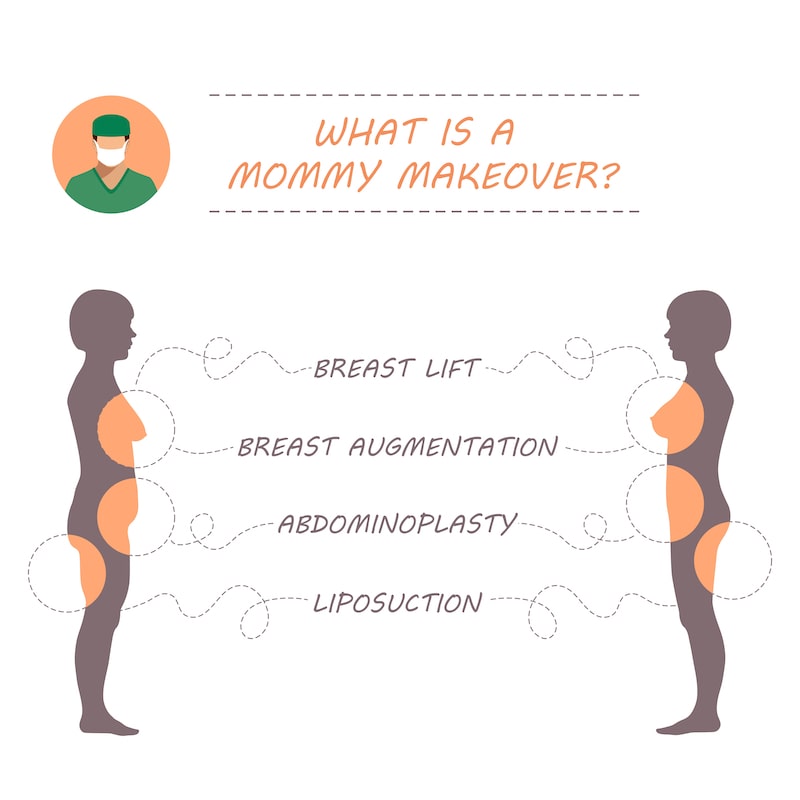 Vector illustration showing the procedures commonly used in a Mommy Makeover.
