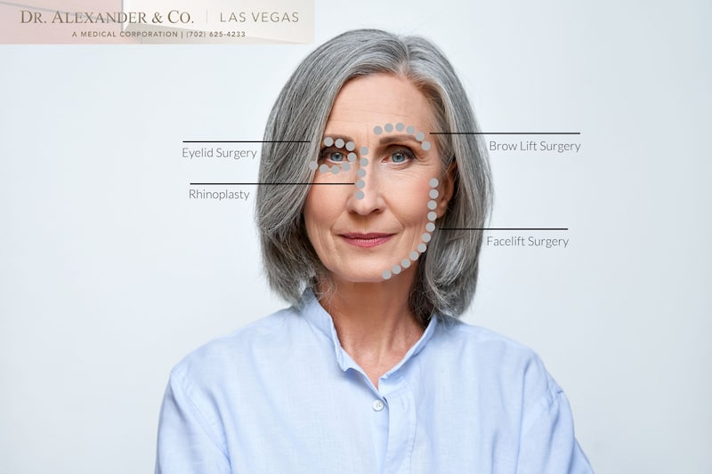 Mature women with lines identifying different areas for facial rejuvenation surgery.