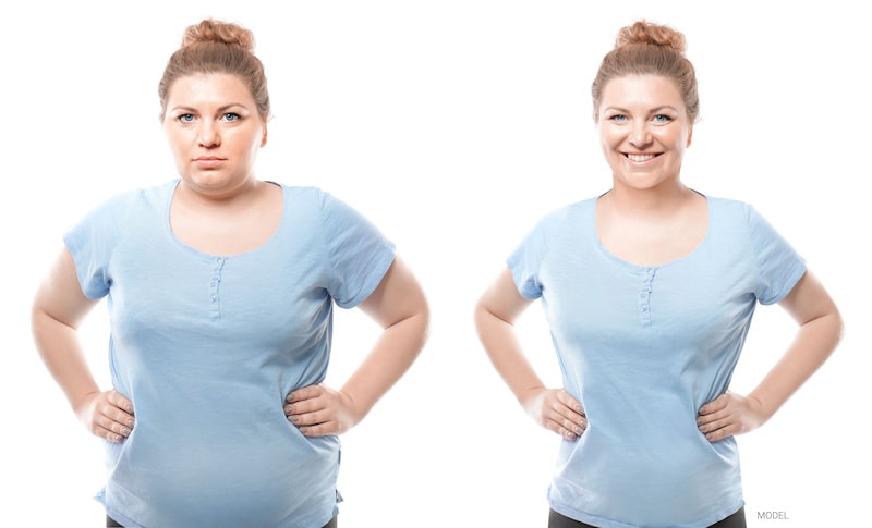 Before and after weight loss photos of a woman wearing a blue shirt